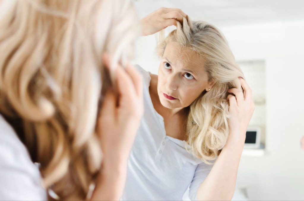 Hair toppers for thinning hair